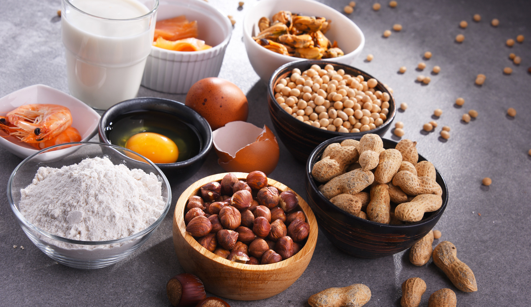 neuronutrition-nourrir-son-cerveau